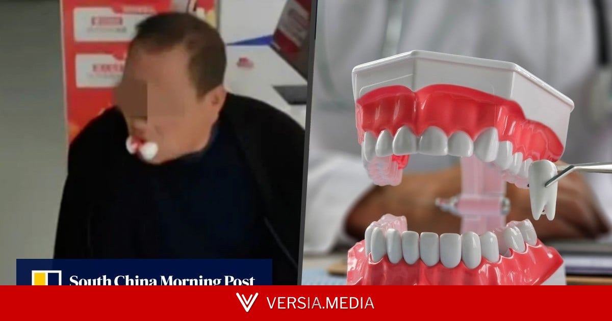 Chinese clinic extracts 12 teeth from man after he complains of ache in one tooth
