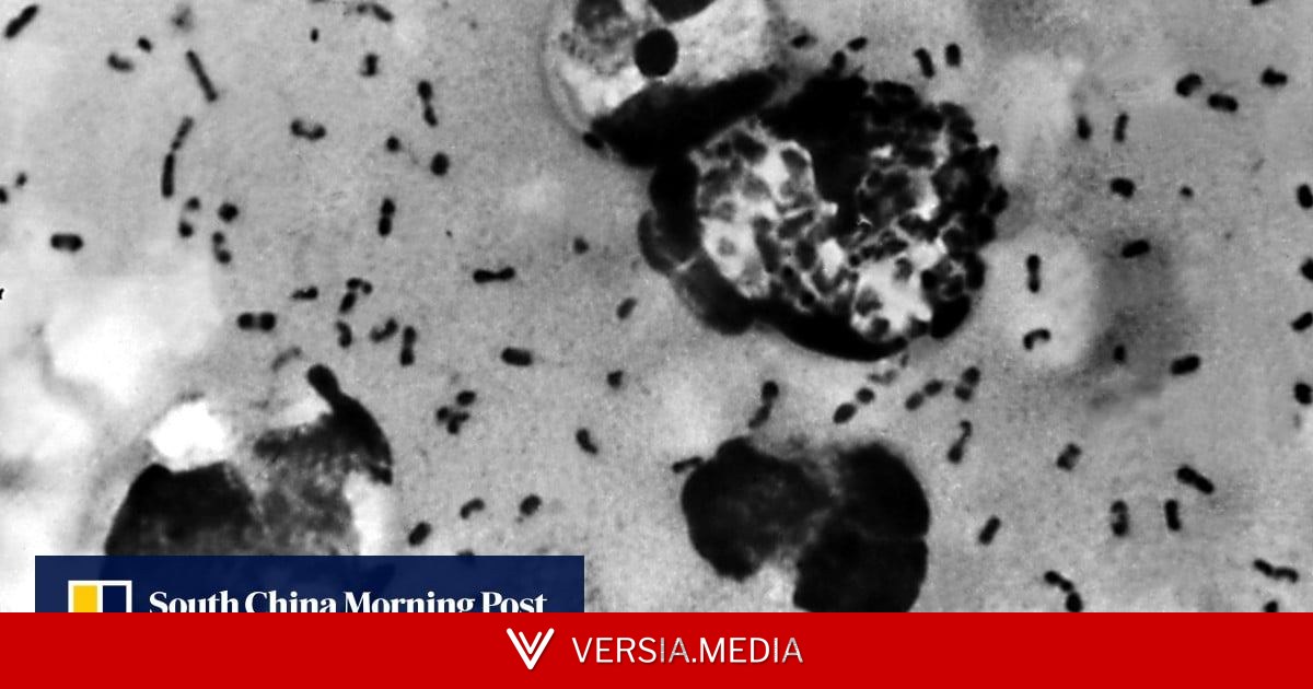 Our ancient enemy: scientists discover oldest-known plague outbreak